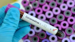 Coronavirus: menos testeos y casos, mientras los muertos siguen arriba de los 100 por día